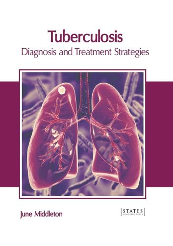 Cover image for Tuberculosis: Diagnosis and Treatment Strategies