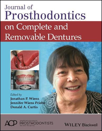 Cover image for Journal of Prosthodontics on Complete and Removable Dentures