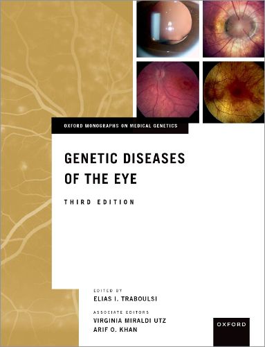 Cover image for Genetic Diseases of the Eye