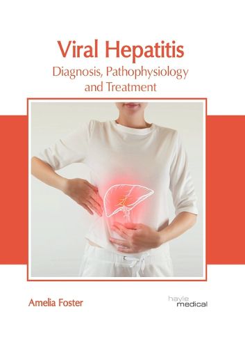 Cover image for Viral Hepatitis: Diagnosis, Pathophysiology and Treatment