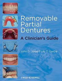 Cover image for Removable Partial Dentures: A Clinician's Guide