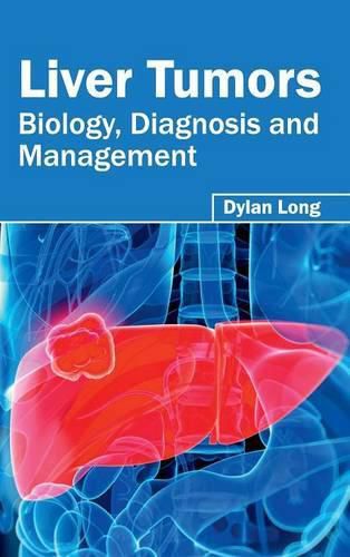 Cover image for Liver Tumors: Biology, Diagnosis and Management