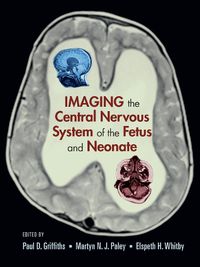 Cover image for Imaging the Central Nervous System of the Fetus and Neonate