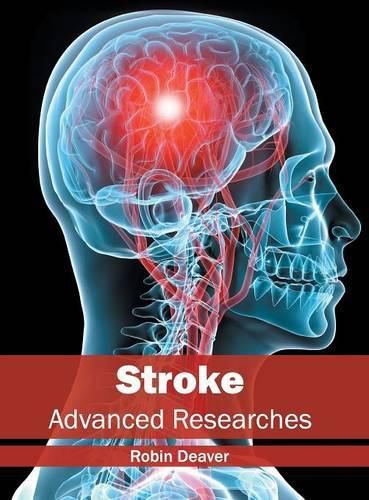 Cover image for Stroke: Advanced Researches