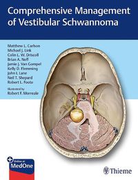 Cover image for Comprehensive Management of Vestibular Schwannoma