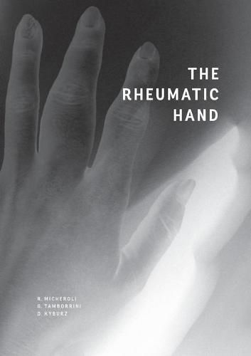 Cover image for The Rheumatic Hand