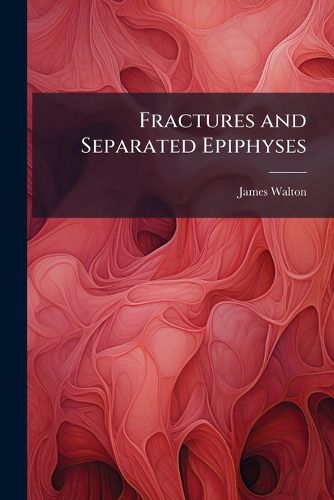 Cover image for Fractures and Separated Epiphyses