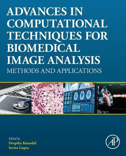 Cover image for Advances in Computational Techniques for Biomedical Image Analysis: Methods and Applications