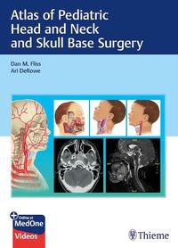 Cover image for Atlas of Pediatric Head and Neck and Skull Base Surgery