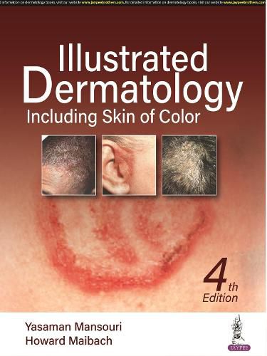 Cover image for Illustrated Dermatology: Including Skin of Colour