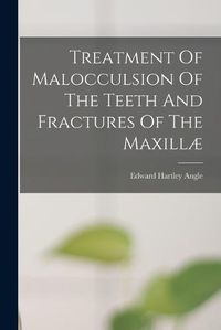 Cover image for Treatment Of Malocculsion Of The Teeth And Fractures Of The Maxillae