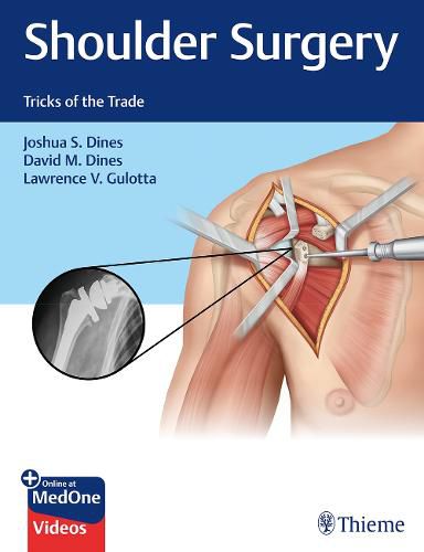 Cover image for Shoulder Surgery: Tricks of the Trade