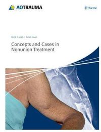 Cover image for Concepts and Cases in Nonunion Treatment