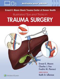 Cover image for Ernest E. Moore Shock Trauma Center at Denver Health Illustrated Tips and Tricks in Trauma Surgery