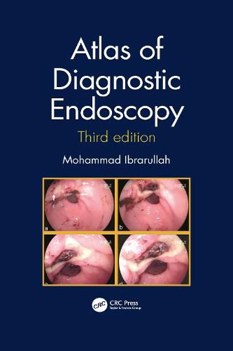 Cover image for Atlas of Diagnostic Endoscopy