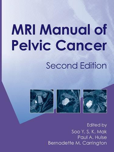 Cover image for MRI Manual of Pelvic Cancer,Second Edition