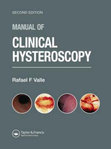 Cover image for Manual of Clinical Hysteroscopy, Second Edition