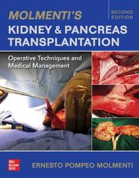 Cover image for Molmenti's Kidney and Pancreas Transplantation: Operative Techniques and Medical Management