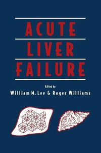 Cover image for Acute Liver Failure