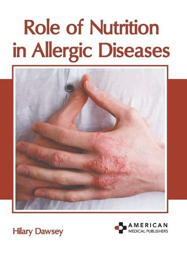 Cover image for Role of Nutrition in Allergic Diseases