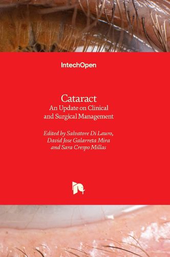 Cover image for Cataract