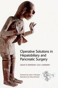 Cover image for Operative Solutions in Hepatobiliary and Pancreatic Surgery