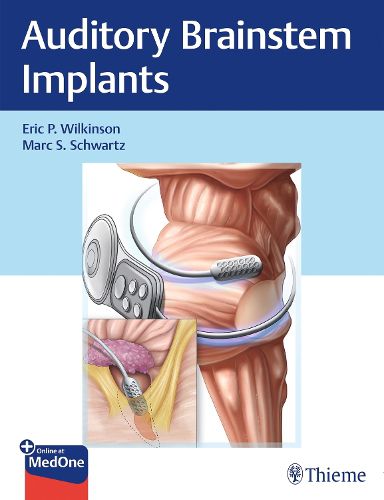 Cover image for Auditory Brainstem Implants