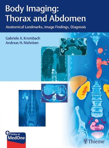 Cover image for Body Imaging: Thorax and Abdomen: Anatomical Landmarks, Image Findings, Diagnosis