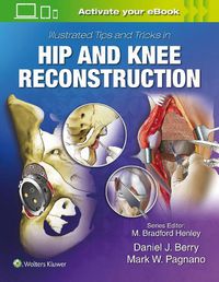 Cover image for Illustrated Tips and Tricks in Hip and Knee Reconstructive and Replacement Surgery