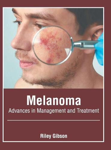 Cover image for Melanoma: Advances in Management and Treatment