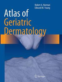 Cover image for Atlas of Geriatric Dermatology