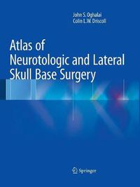 Cover image for Atlas of Neurotologic and Lateral Skull Base Surgery