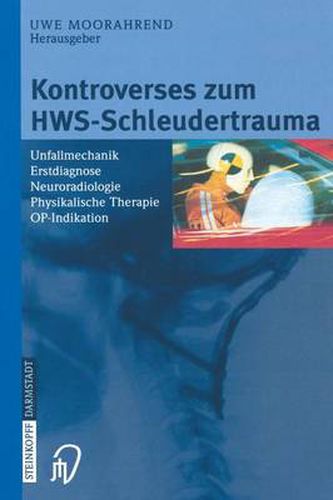 Cover image for Kontroverses Zum Hws-Schleudertrauma: Unfallmechanik Erstdiagnose Neuroradiologie Physikalische Therapie Op-Indikation