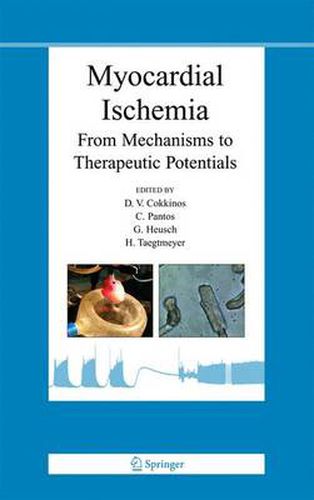 Cover image for Myocardial Ischemia: From Mechanisms to Therapeutic Potentials