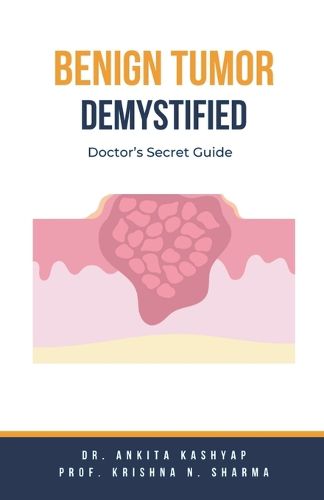 Benign Tumor Demystified