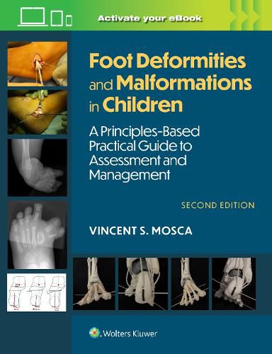 Cover image for Foot Deformities and Malformations in Children