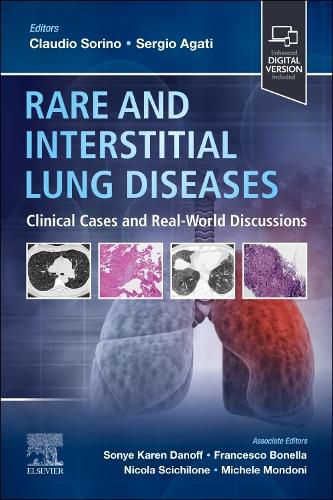 Cover image for Rare and Interstitial Lung Diseases