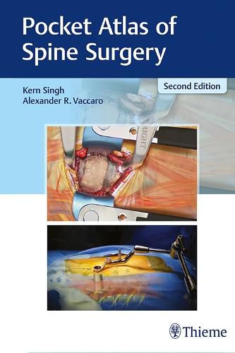 Cover image for Pocket Atlas of Spine Surgery