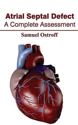 Cover image for Atrial Septal Defect: A Complete Assessment