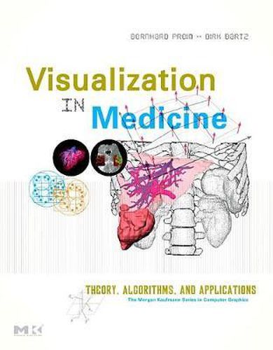 Visual Computing for Medicine: Theory, Algorithms, and Applications