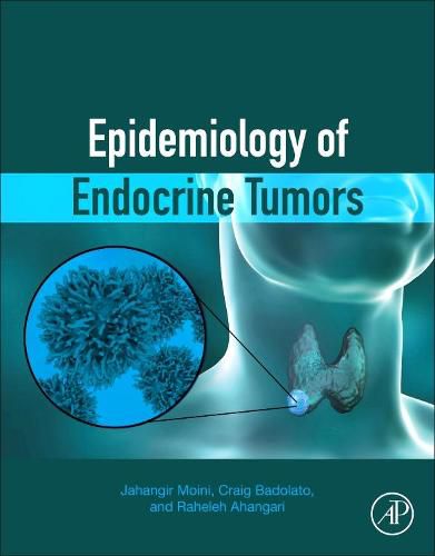 Cover image for Epidemiology of Endocrine Tumors