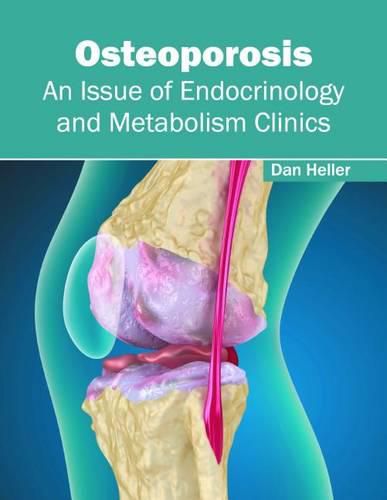 Cover image for Osteoporosis: An Issue of Endocrinology and Metabolism Clinics