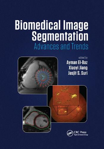 Cover image for Biomedical Image Segmentation: Advances and Trends