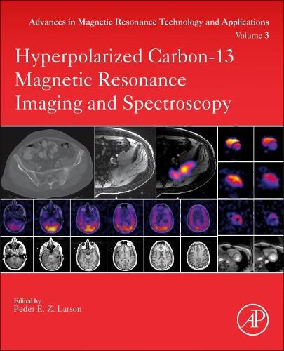 Cover image for Hyperpolarized Carbon-13 Magnetic Resonance Imaging and Spectroscopy