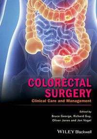 Cover image for Colorectal Surgery: Clinical Care and Management