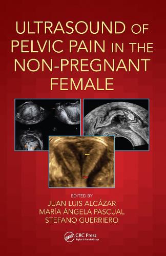 Cover image for Ultrasound of Pelvic Pain in the Non-Pregnant Female
