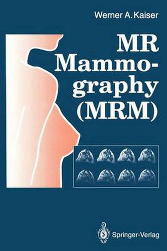 Cover image for MR Mammography (MRM)