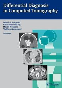 Cover image for Differential Diagnosis in Computed Tomography