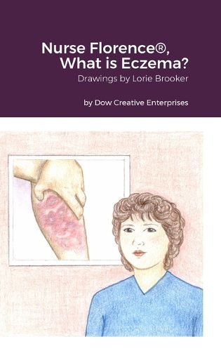 Cover image for Nurse Florence(R), What is Eczema?