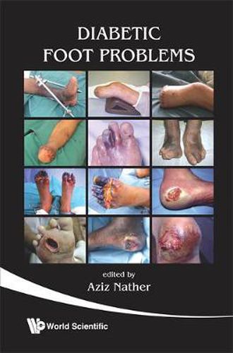 Cover image for Diabetic Foot Problems